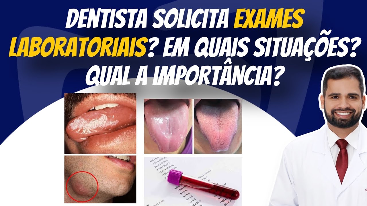 Exames laboratoriais: Em quais situações o dentista deve solicitar? Qual a importância #exames