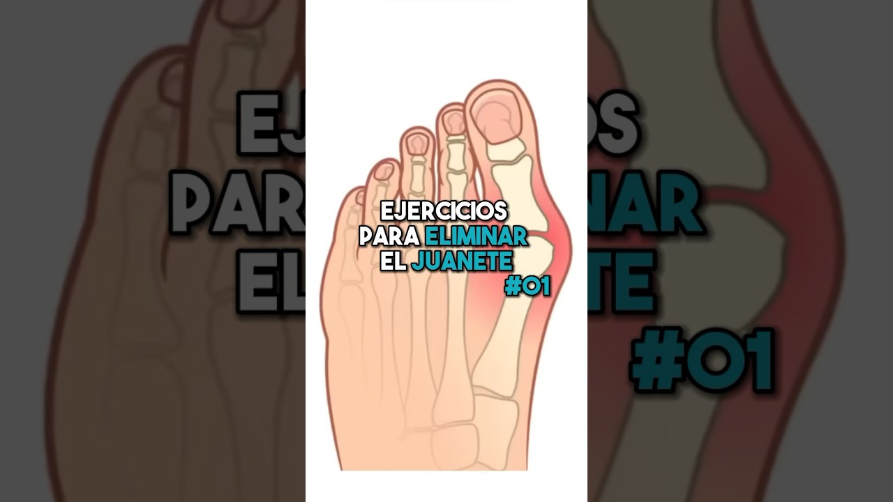 ☑️Ejercicio para eliminar el juanete. P1 ❗️ #fisioterapiatualcance