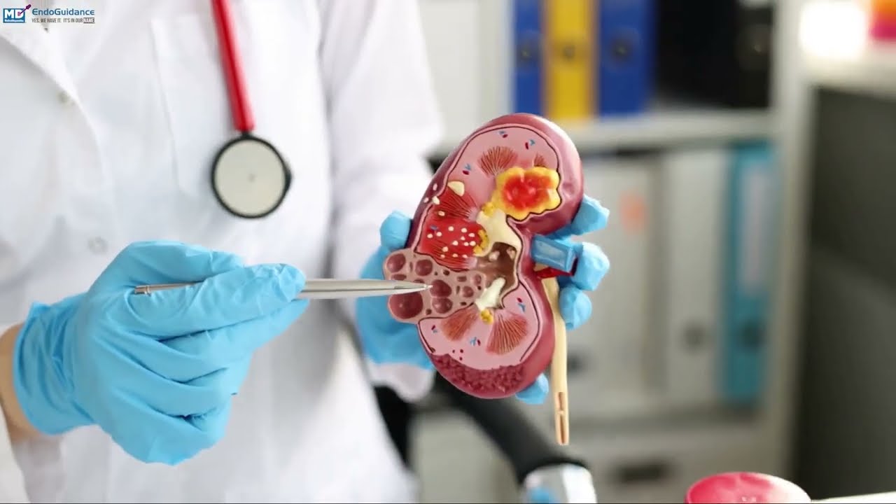 Advancing Kidney Care: A Closer Look at Laparoscopic Nephrectomy