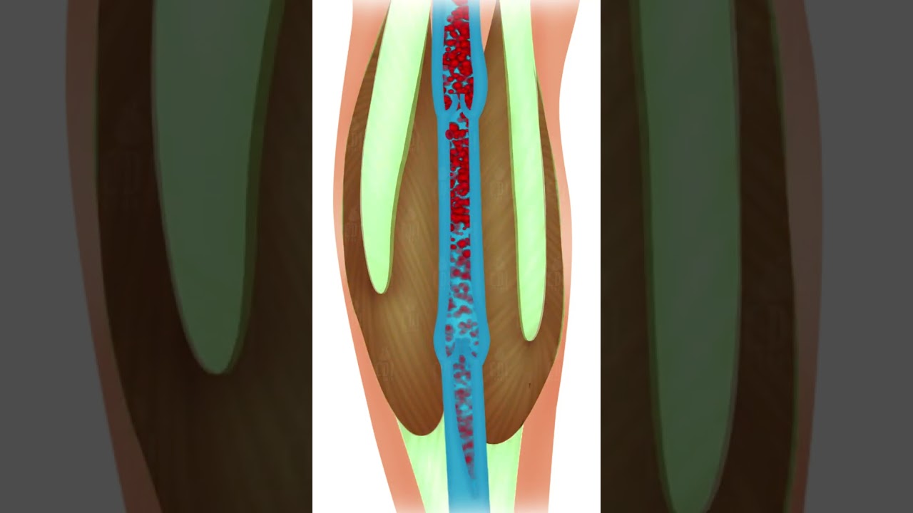 Boost Your Calf&rsquo;s Blood Flow | 3D Animation for Better Circulation
