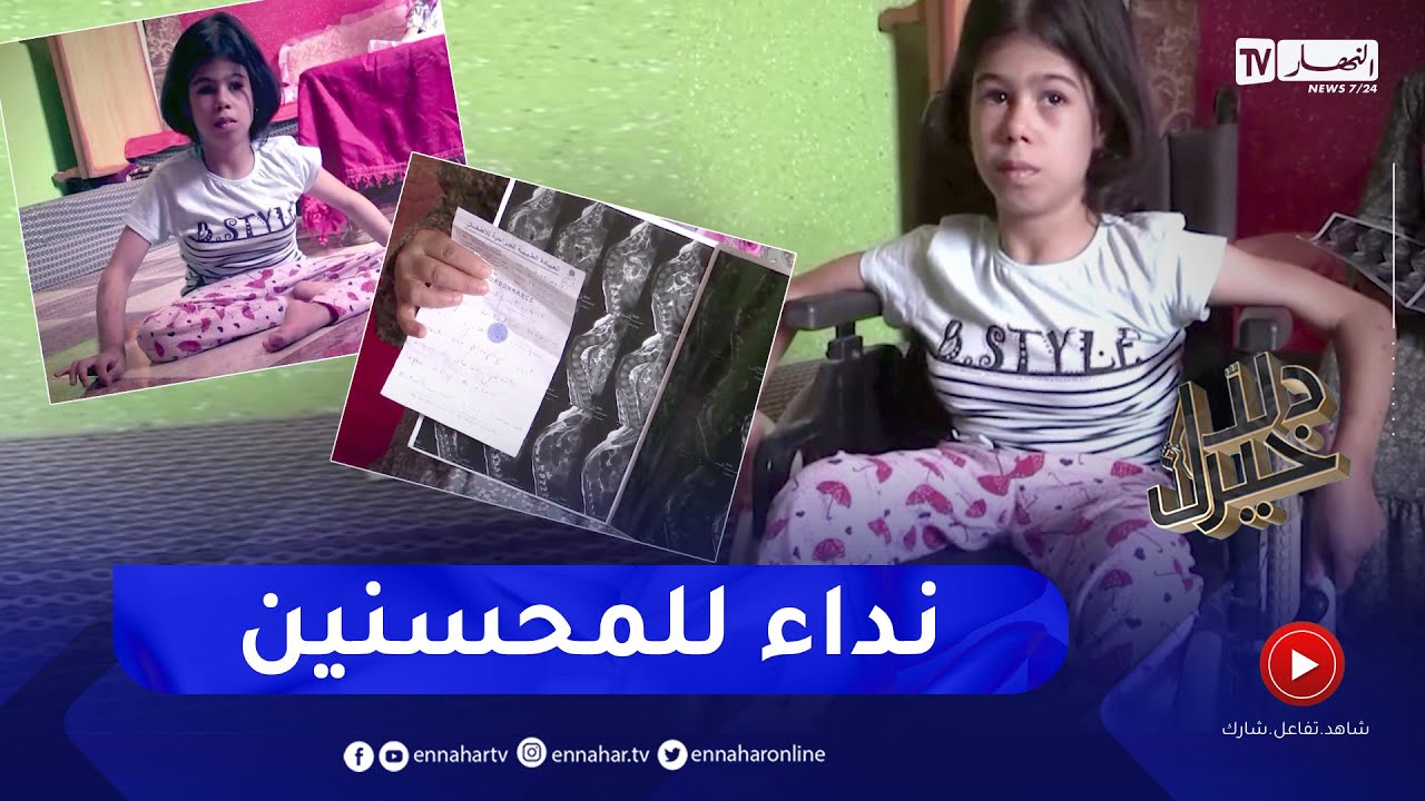 دلال خير: طفلة تعاني من مرض سبينا بيفيدا تحتاج إلى عملية جراحية في الخارج