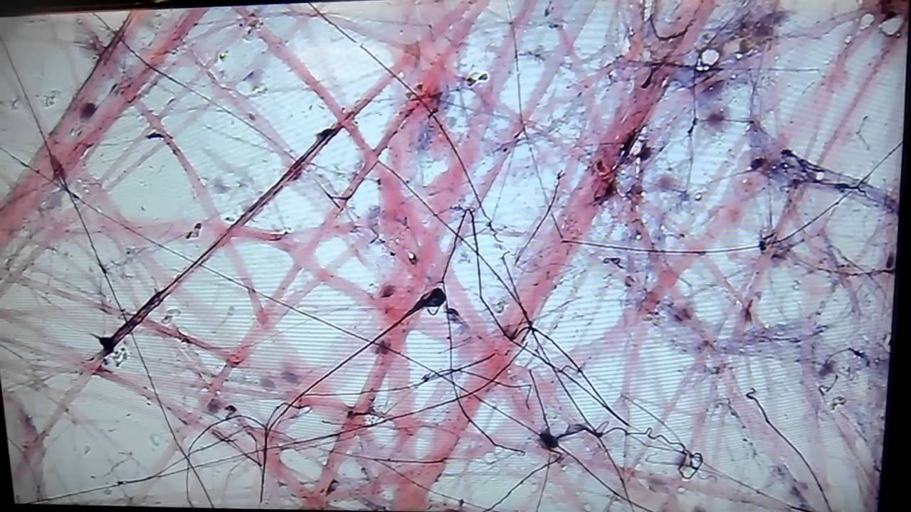 A&P1 Lab#3 areolar connective tissue