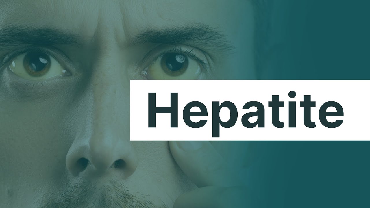 MEDICINA NA VIDA REAL: hepatite | Promedicina