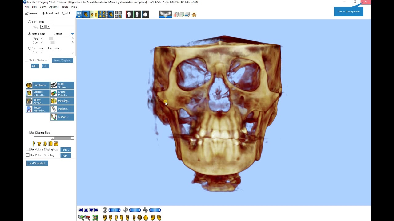 Cirug&iacute;a Maxilofacial y Cirug&iacute;a Ortogn&aacute;tica 3d