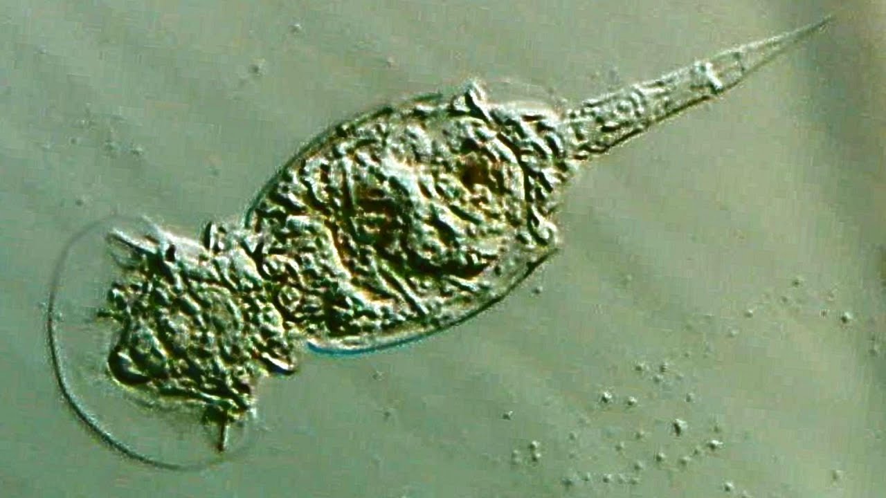 verschiedene R&auml;dertierchen -  (different Rotifer, Rotifera oder Rotatoria)