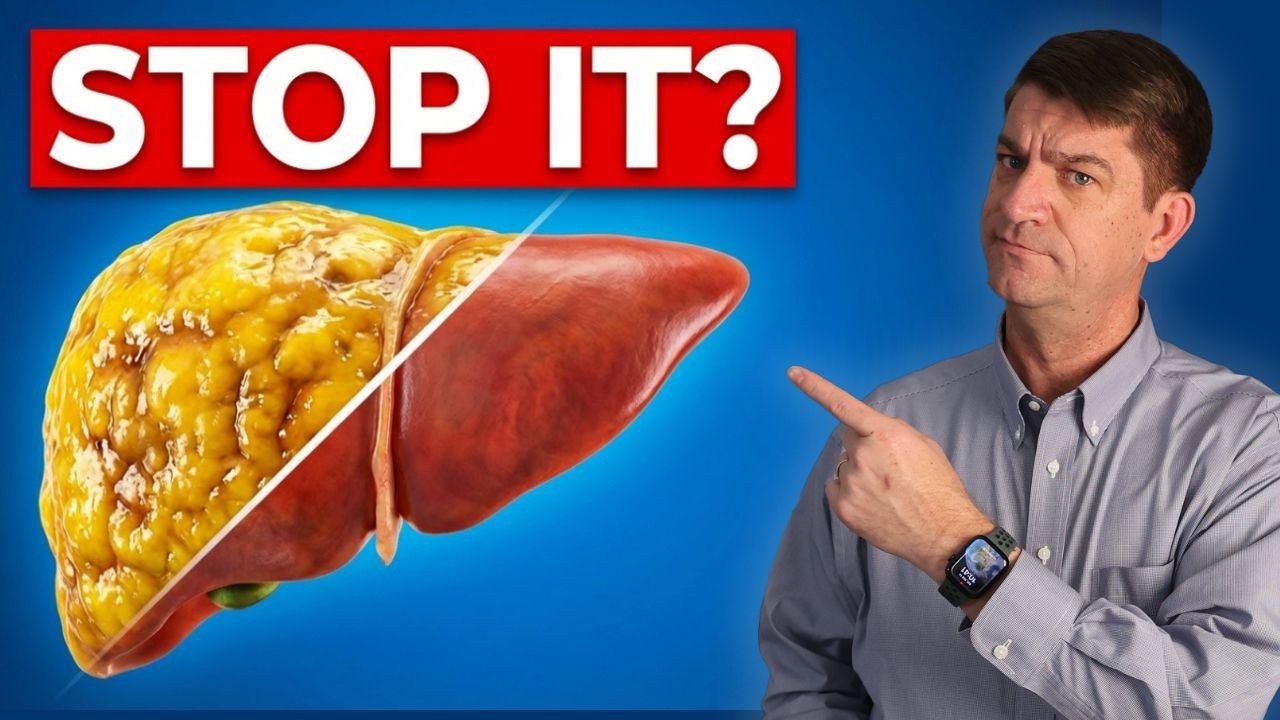 Fix Your Fatty Liver in 6 Simple Steps!