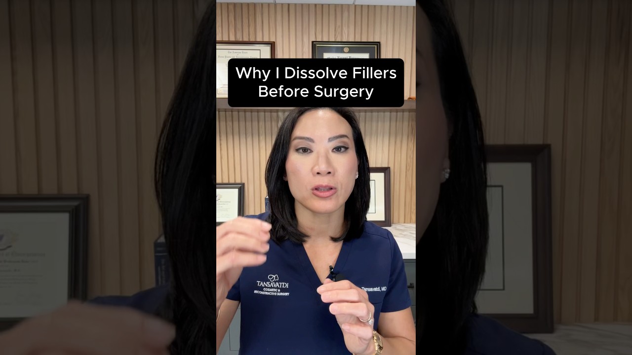 Why I Dissolve Fillers Before Surgery #facelift #filler