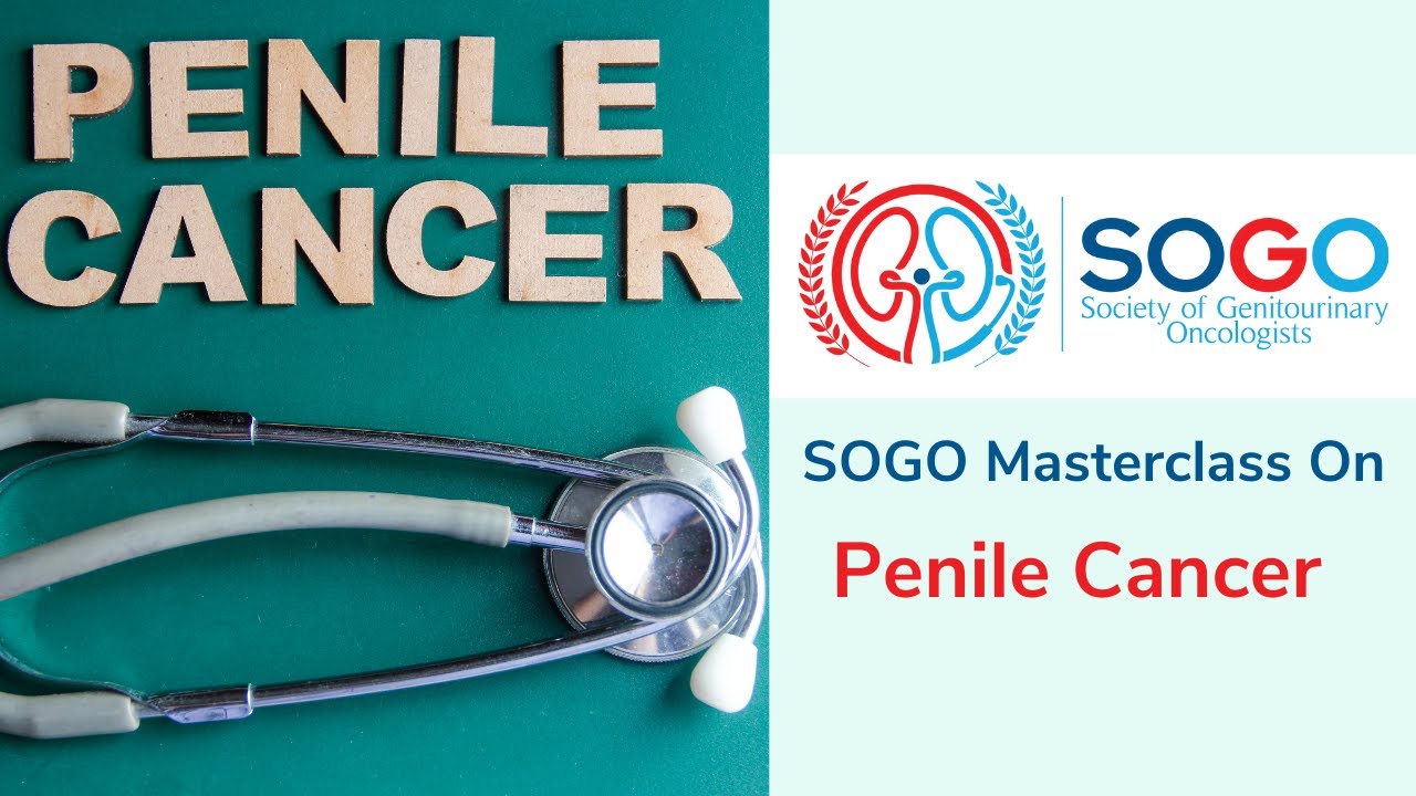 SOGO Masterclass   Penile Cancer