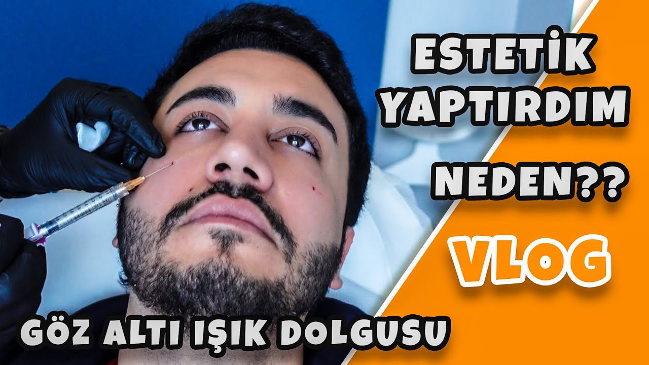 ESTETİK YAPTIRDIM !! (Gözaltı Işık Dolgusu) - VLOG