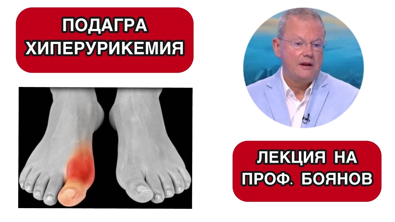 ПОДАГРА и хиперурикемия- особености и лечение. Проф. Михаил Боянов
