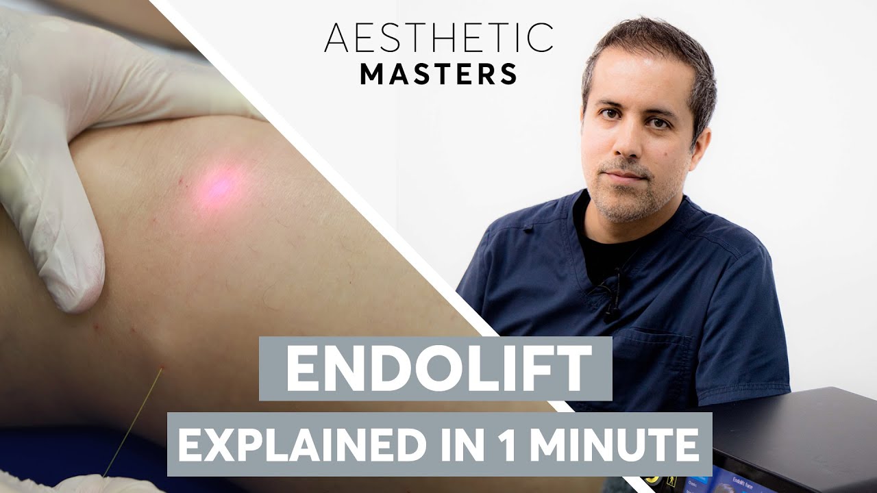 Endolift Explained - Non Surgical Treatment for Skin tightening & Fat Reduction｜London