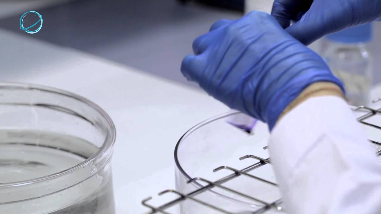 EHAS: Diagnóstico de Malaria (Gota gruesa)