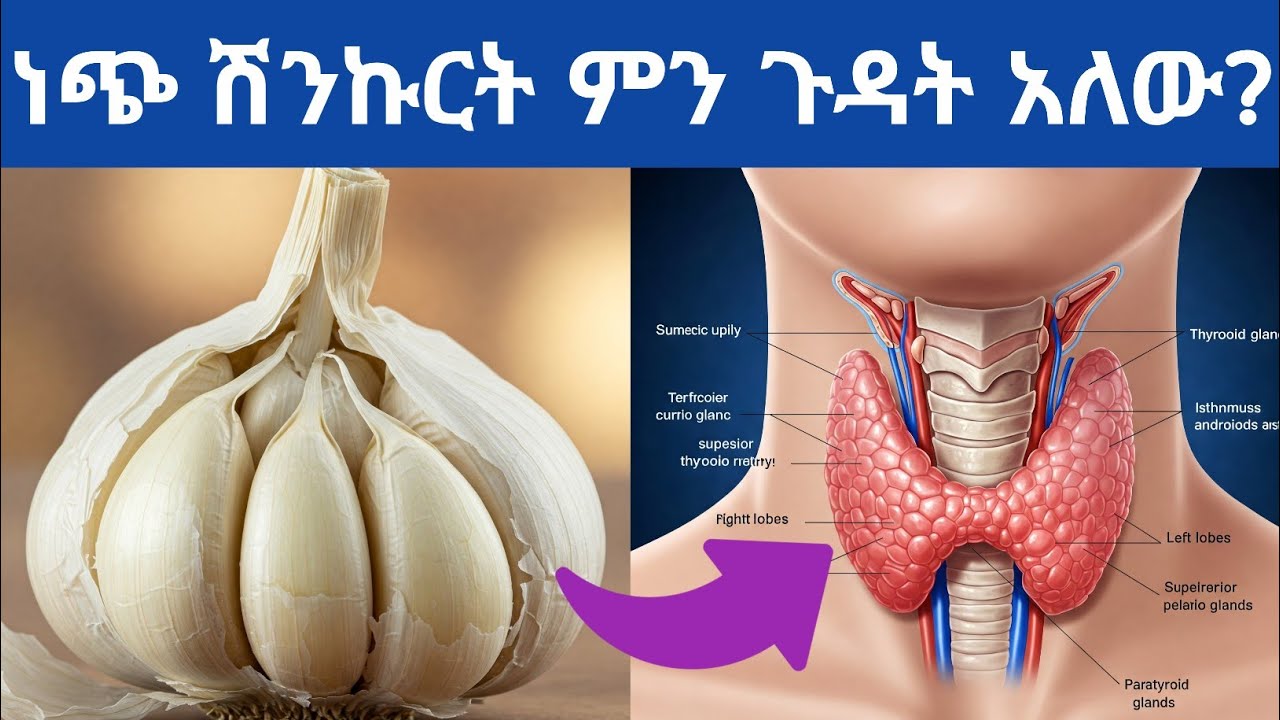 ከመጠን በላይ ነጭ ሽንኩርት መመገብ ምን ጉዳት አለው ፣ በቀን ምን ያክል መጠቀም አለባችሁ| Side effects of eating too much Garlic