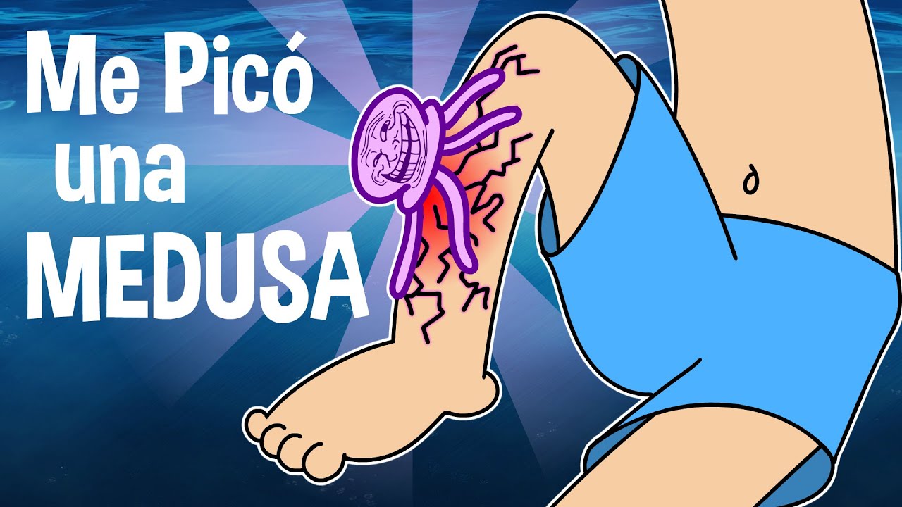 ¡Me picó una MEDUSA! - Batakomics