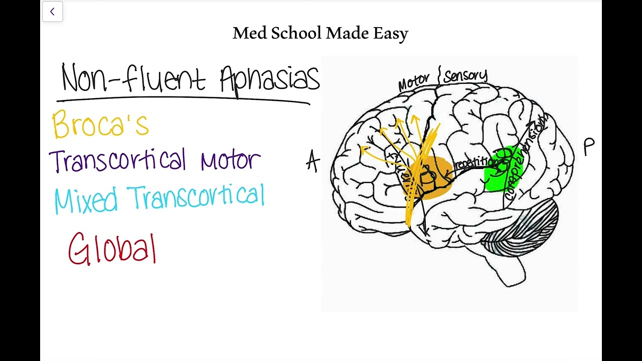 Non-Fluent Aphasias Made Easy: How to Distinguish and Remember Them!