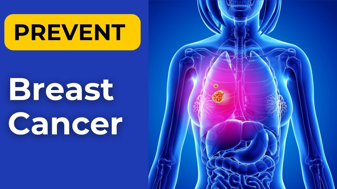 Secret Natural Foods for Breast Cancer Prevention