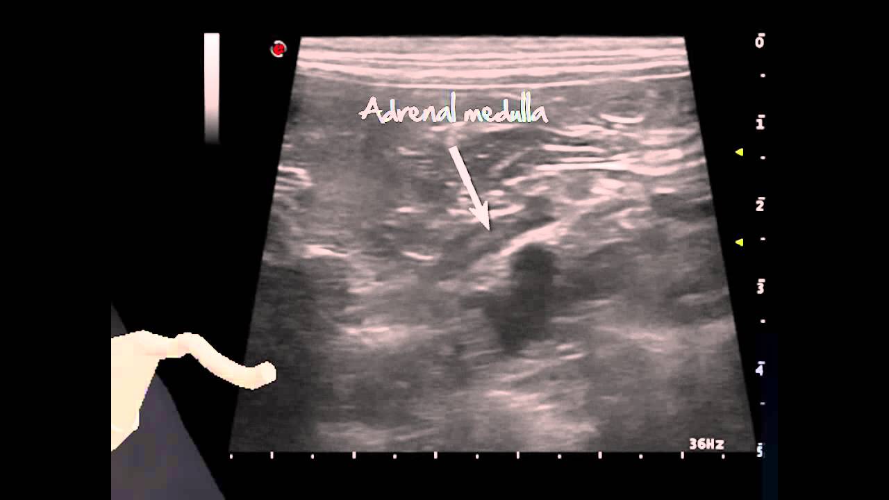 Adrenals in Dogs - Ultrasound approach and anatomy with 3D animations