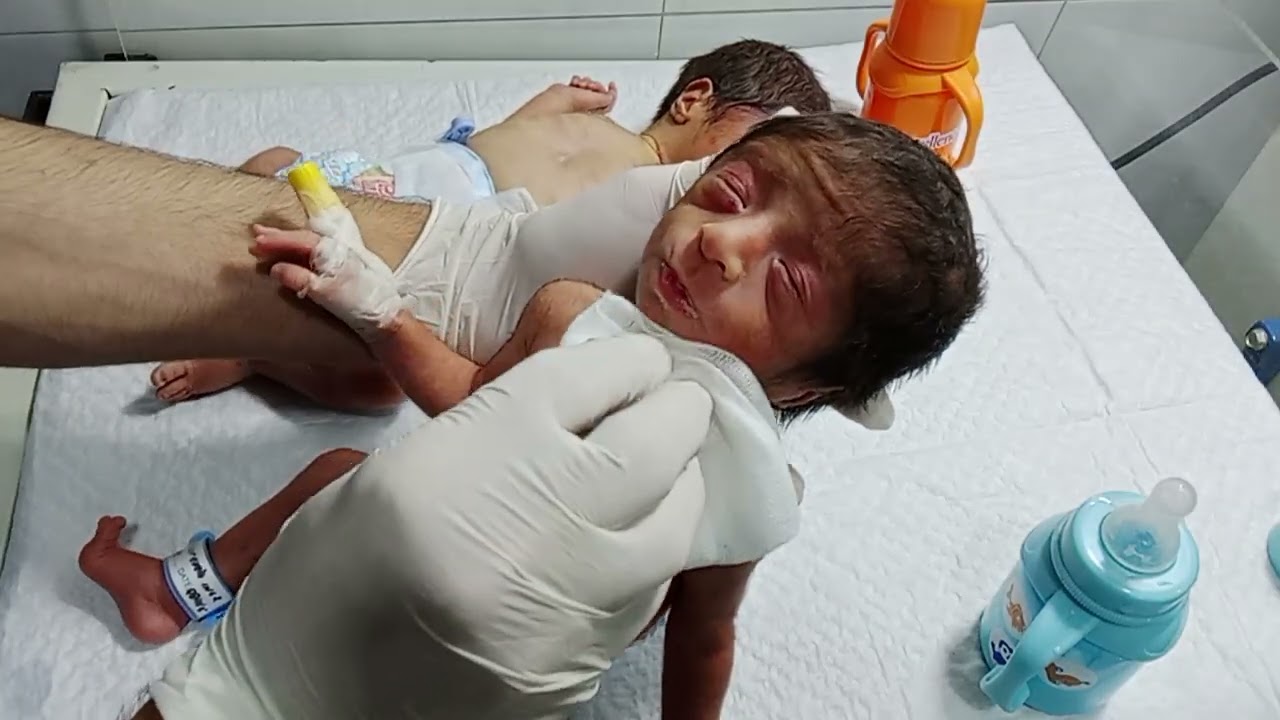 Twins Premature RDS Babies | Recovery & First Feeding Try | NICU Care Journey#newborncare#nicucare 