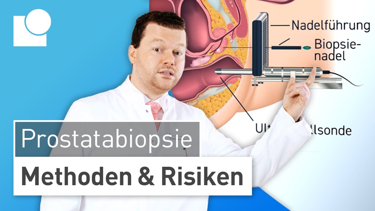 Prostatabiospie: Methoden & Risiken – Gewebeentnahme zur sicheren Prostatakrebs-Diagnose