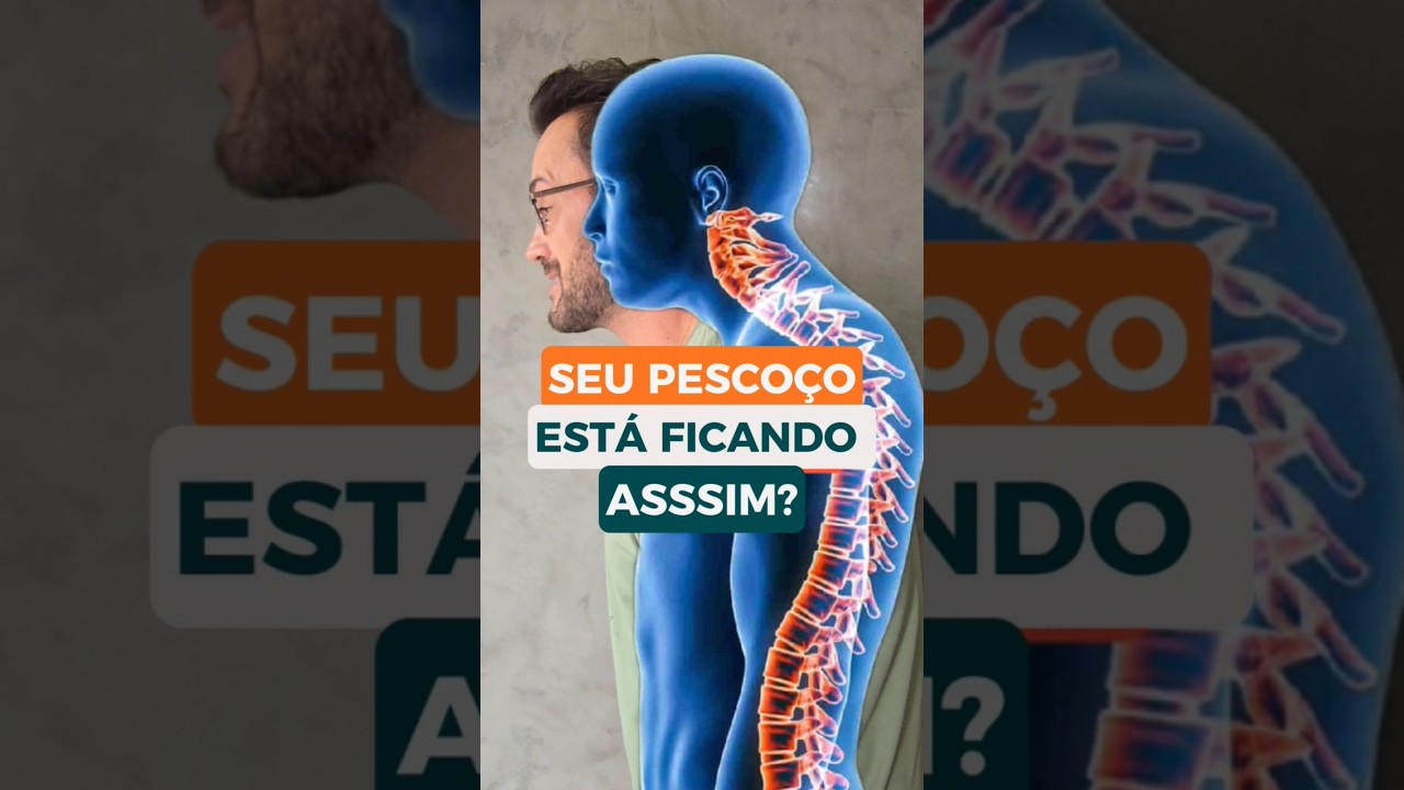COMO CORRIGIR O PESCO&Ccedil;O #cervical #corcunda #fisioprev
