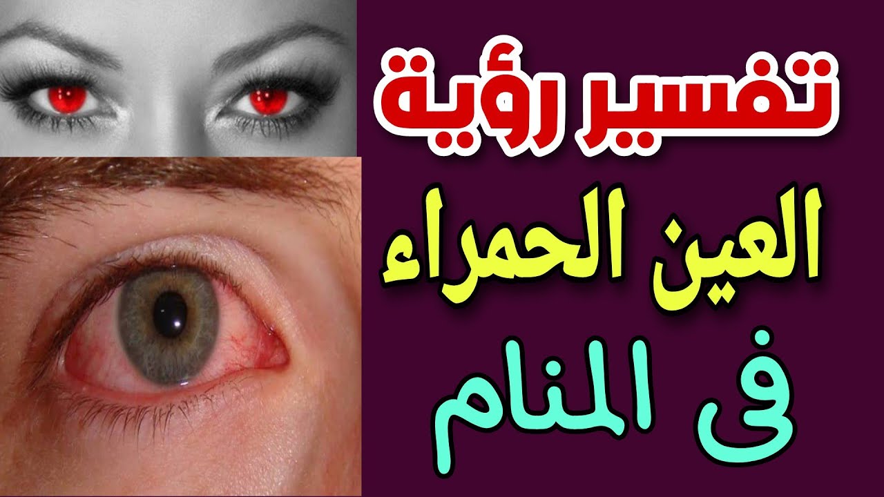 تفسير رؤية العين الحمراء فى المنام ما معنى رؤية أحمرار العين فى المنام