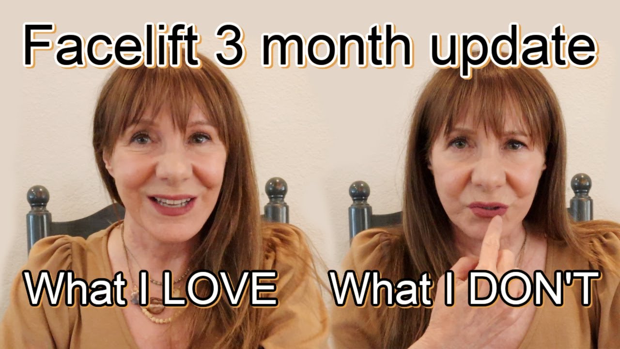 Facelift 3 Month Update-What I like & don't like!