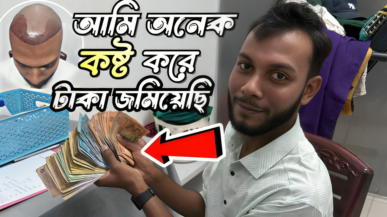 তিলি তিলে টাকা জমিয়ে হেয়ার ট্রান্সপ্লান্ট করতে আসলেন! টাক মাথায় চুলে হেয়ার ট্রান্সপ্লান্ট বাংলাদেশ