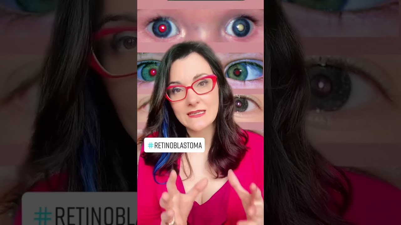Don't IGNORE This Sign. EYE CANCER in children #retinoblastoma  #eyecancer
