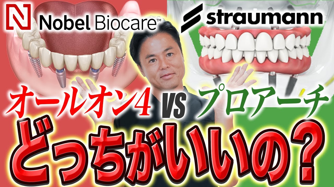 【オールオン4 VS プロアーチ】結局どっちがいいの？