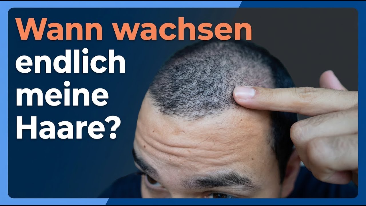 Haartransplantation T&uuml;rkei: Wann wachsen endlich meine Haare? | Dr. Balwi erkl&auml;rt
