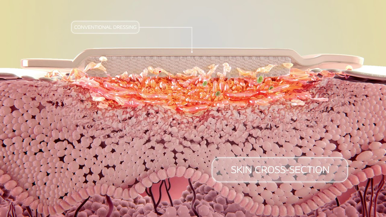 Biatain Silicone 3DFit Technology Animation