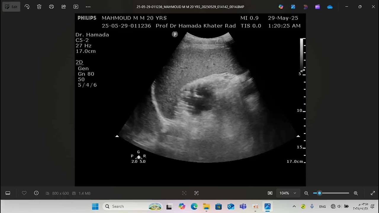 Record 2025 07 28 Prof. Dr Hamada Khater BEST ULTRASOUND AND DOPPLER CASES