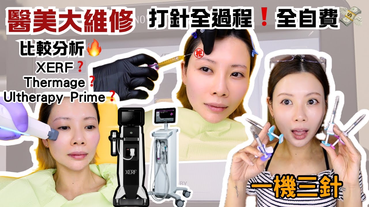 【🇭🇰香港醫美大維修💉直擊打針過程❗️全自費💸】最新一機三針｜👤醫生面診｜教你分辨填充劑｜XERF｜Ultherapy Prime｜Thermage｜Skinvive Volift Volbella 