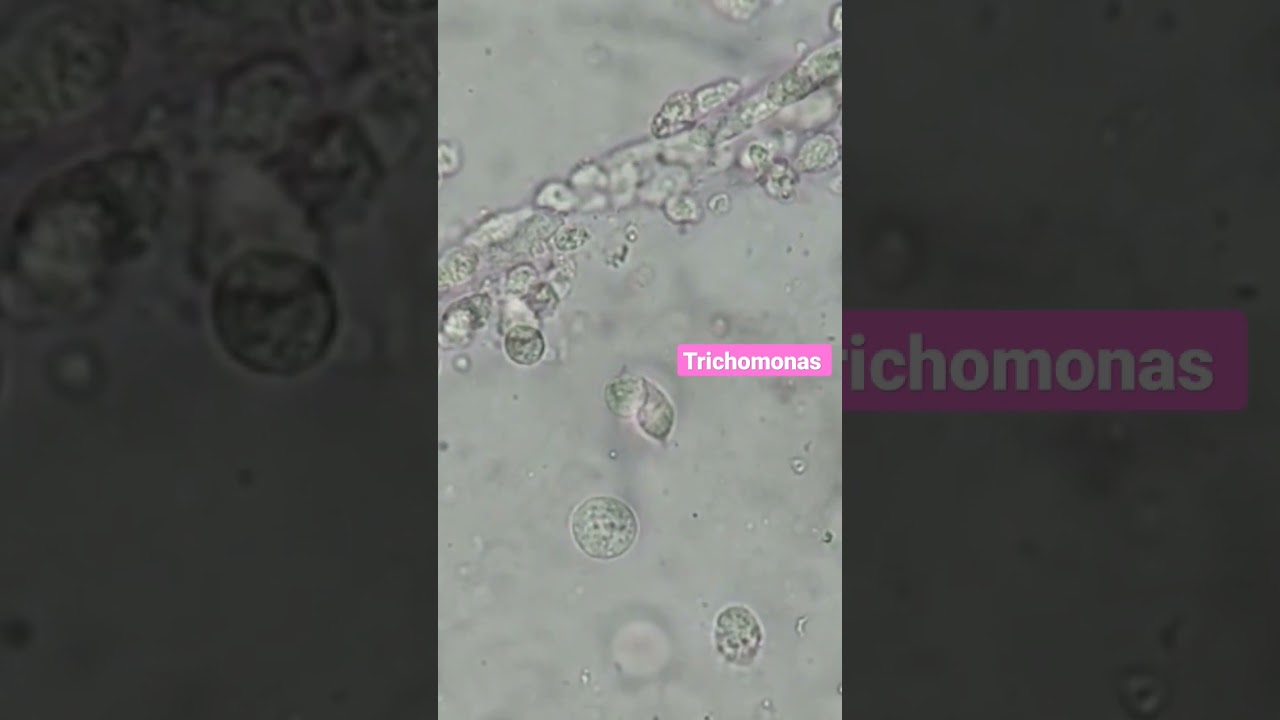 Trichomonas