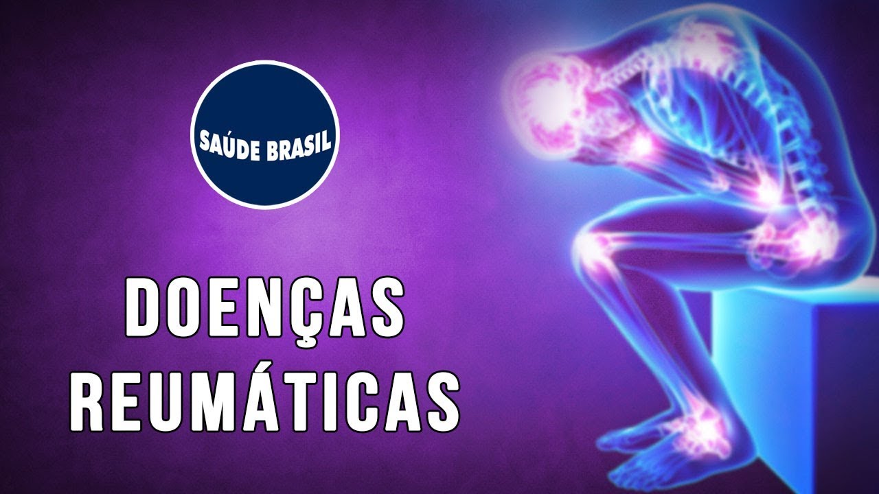DOENÇAS REUMÁTICAS: GOTA, LÚPUS, FIBROMIALGIA, SAF | SÉRIE SAÚDE BRASIL