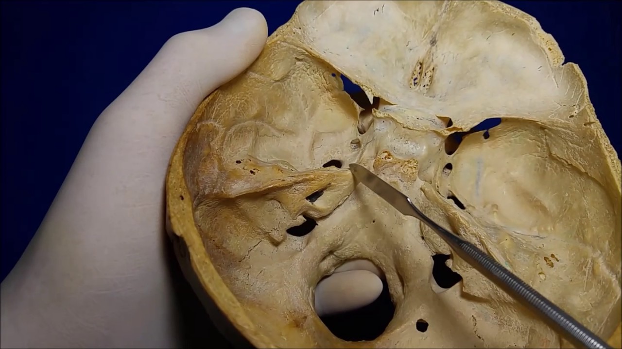 Base del cráneo (vista superior)