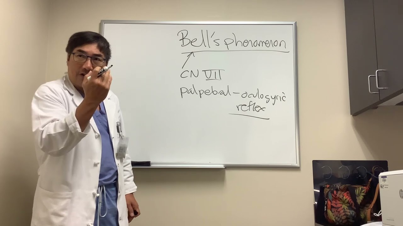 Bell&rsquo;s phenomenon in NOP