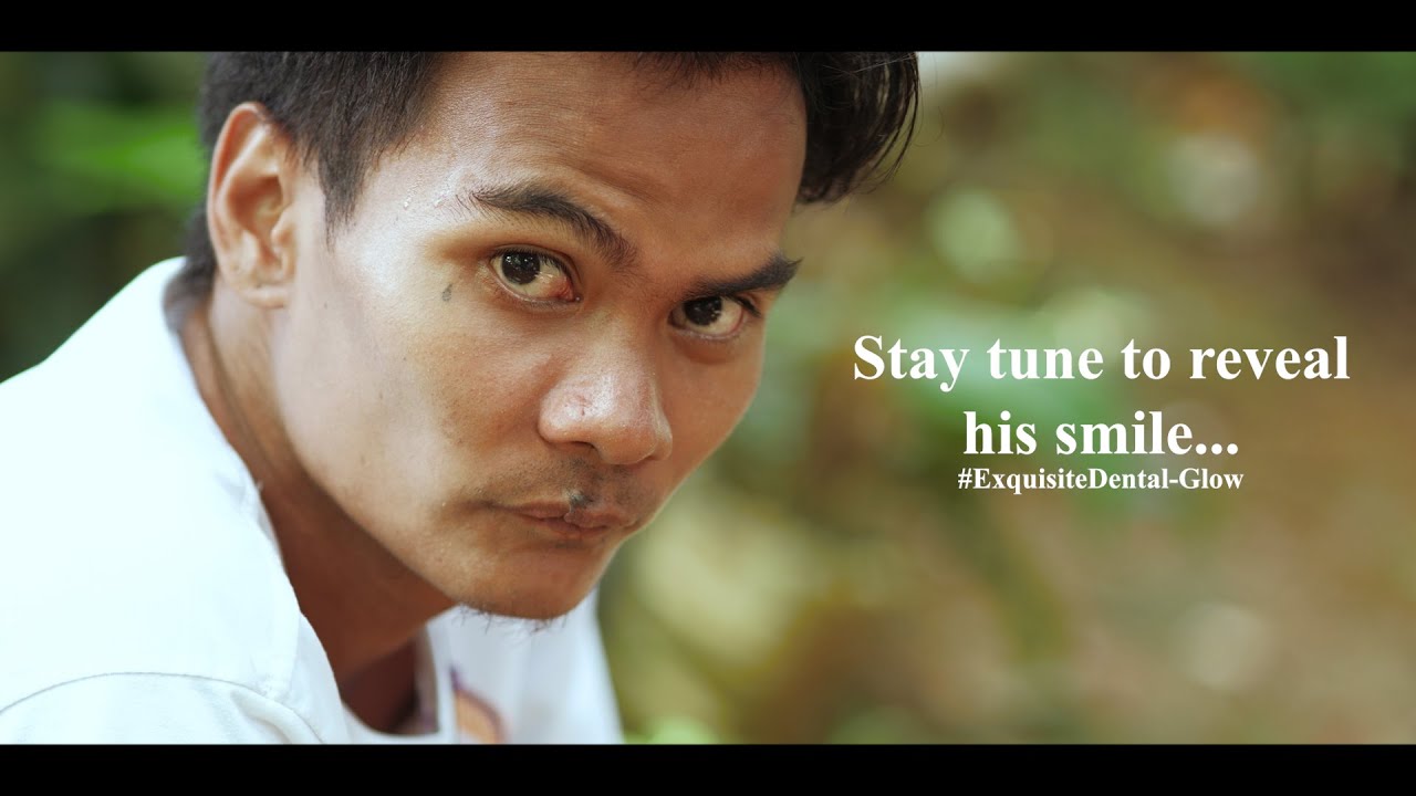 Exquisite Dental Glow Up - MJ Acupanda (Full Video)