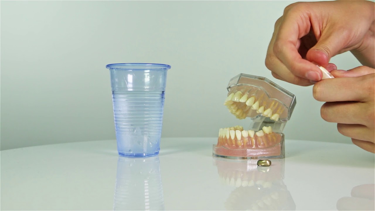 Dr Denti -Refit Crown - How to temporarily re-cement dislodged crown bridges, veneers