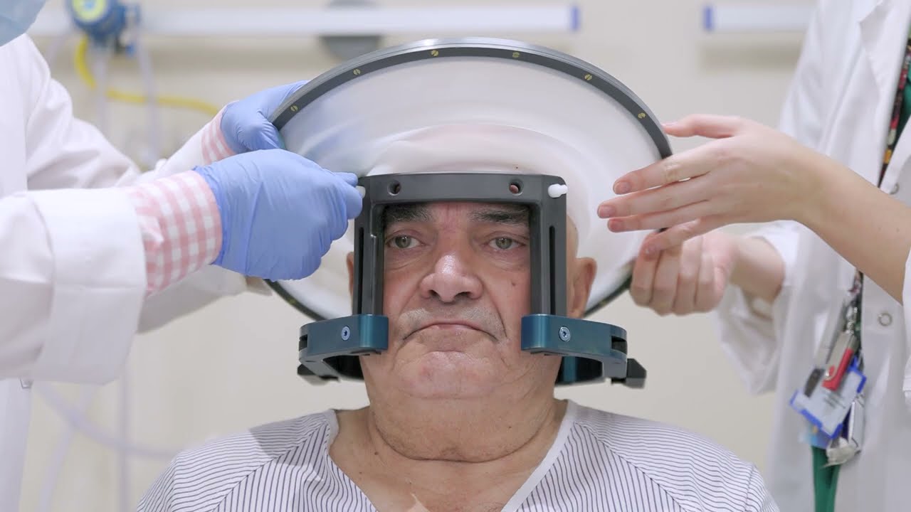 Ultrasonidos Focalizados de Alta Intensidad (HIFU) para el tratamiento de temblores