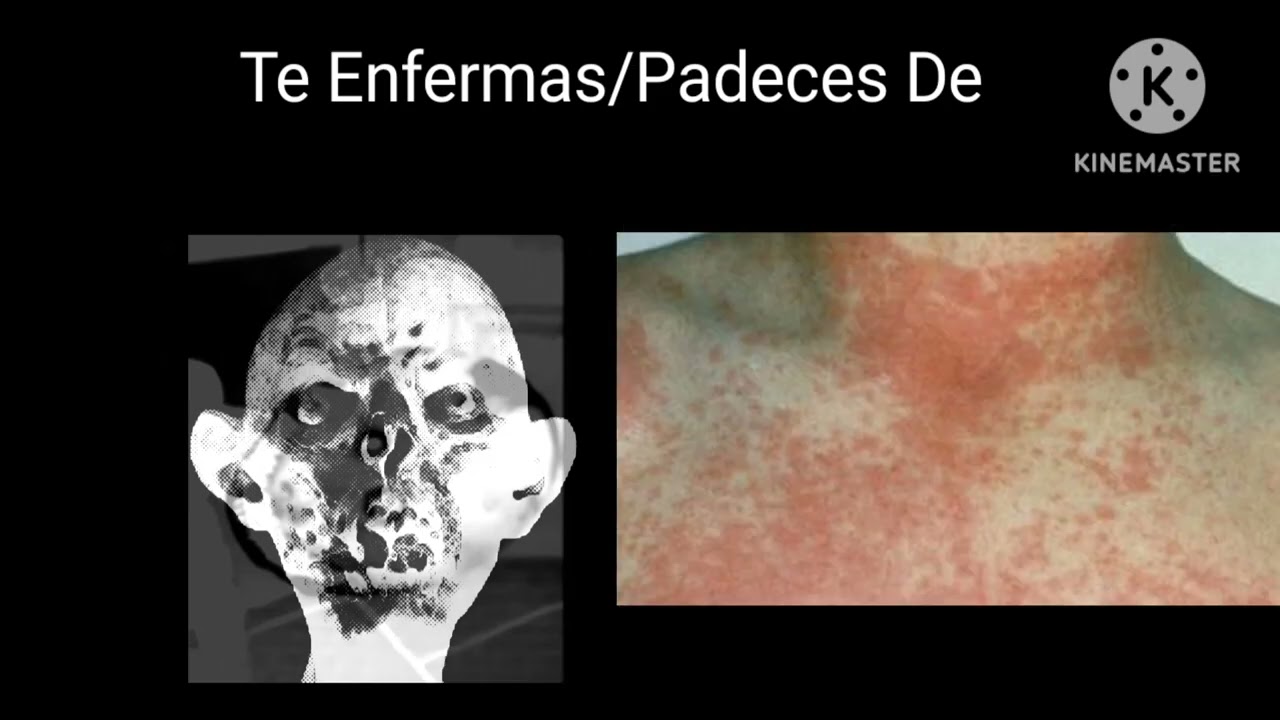 Mr increíble perturbado te enfermas de...(Remasterizado)