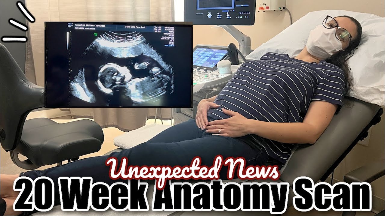 Unexpected Finding at 20 Week Anatomy Scan! NOT Good News | Pregnancy Vlog