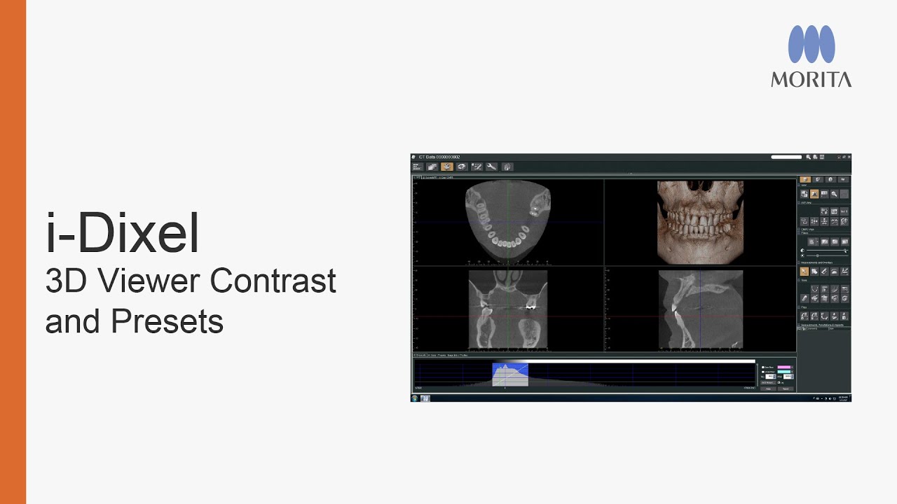 i-Dixel 3D Viewer - Contrast And Presets
