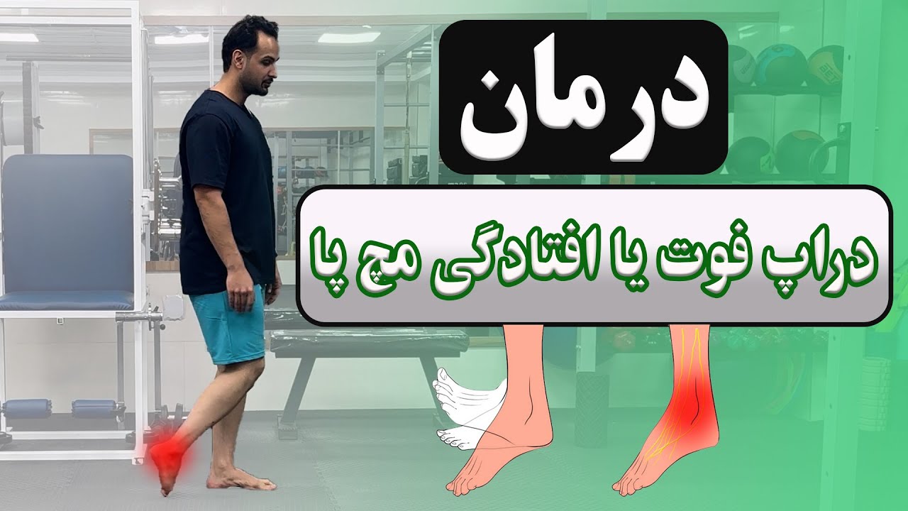 درمان دراپ فوت یا افتادگی مچ پا