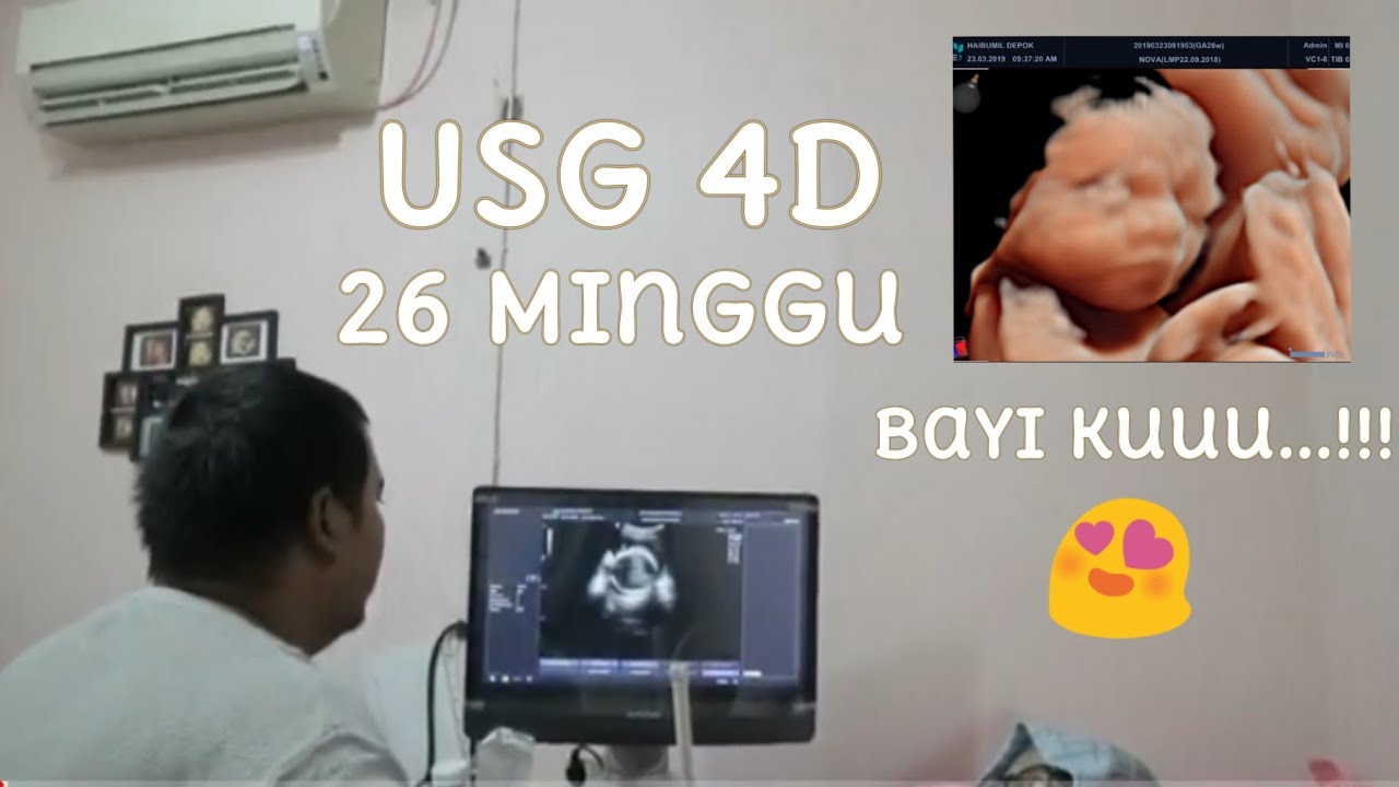 USG 4 DIMENSI (4D) USIA KEHAMILAN 26 MINGGU @ HAI BUMIL DEPOK | KEHAMILAN