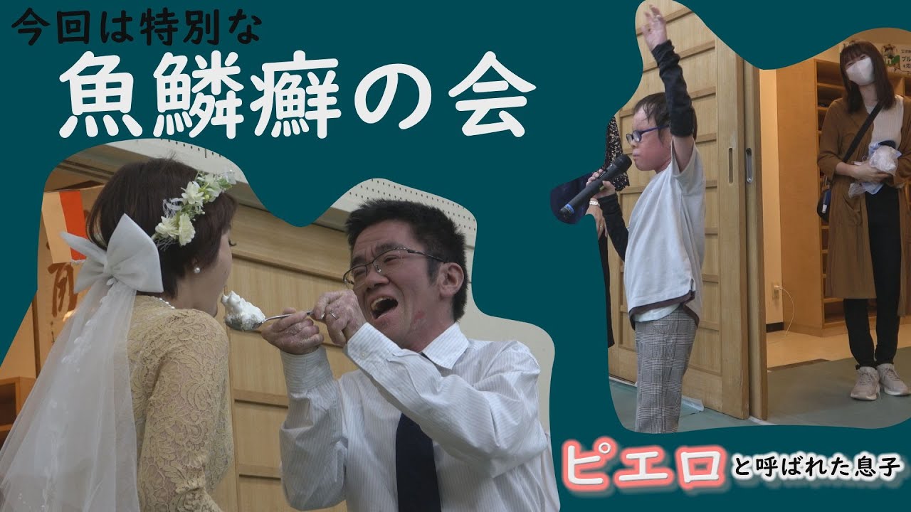 魚鱗癬と闘ってきた男性が結婚…魚鱗癬の会でお披露目～　配信型ドキュメンタリー「ピエロと呼ばれた息子」第１０４話
