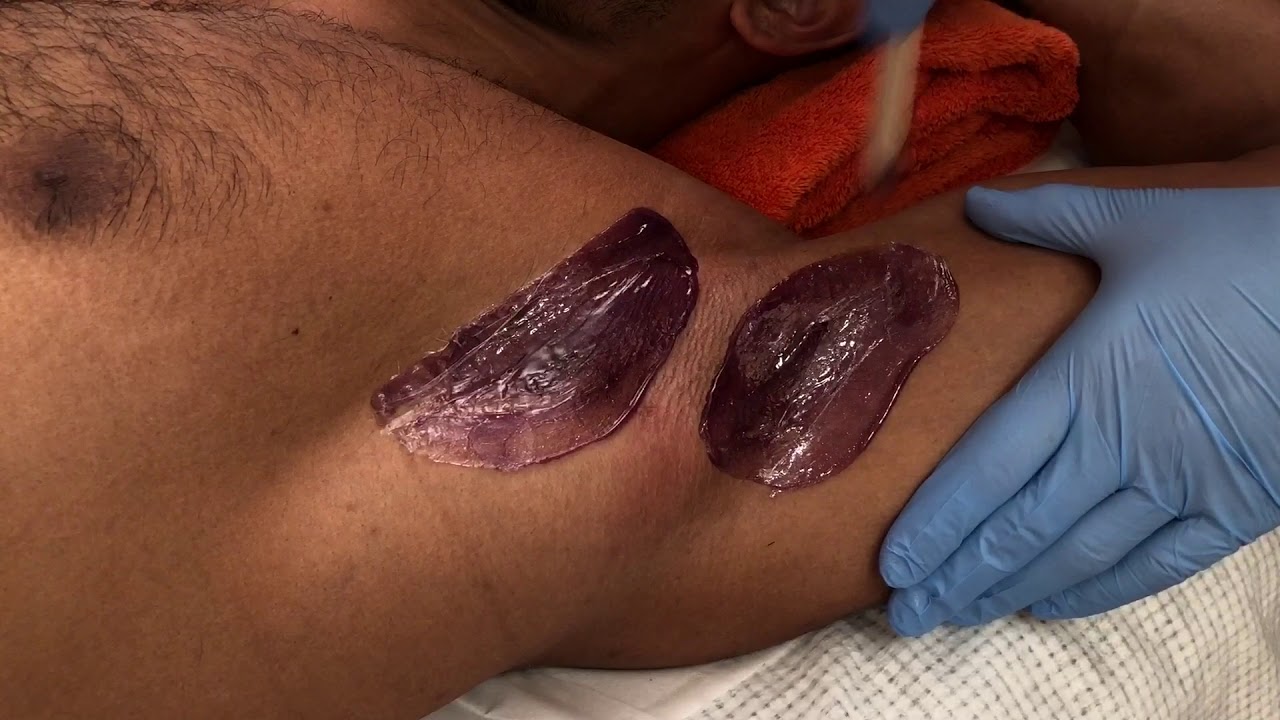 Male underarm waxing with Ashmira Botanica hot wax