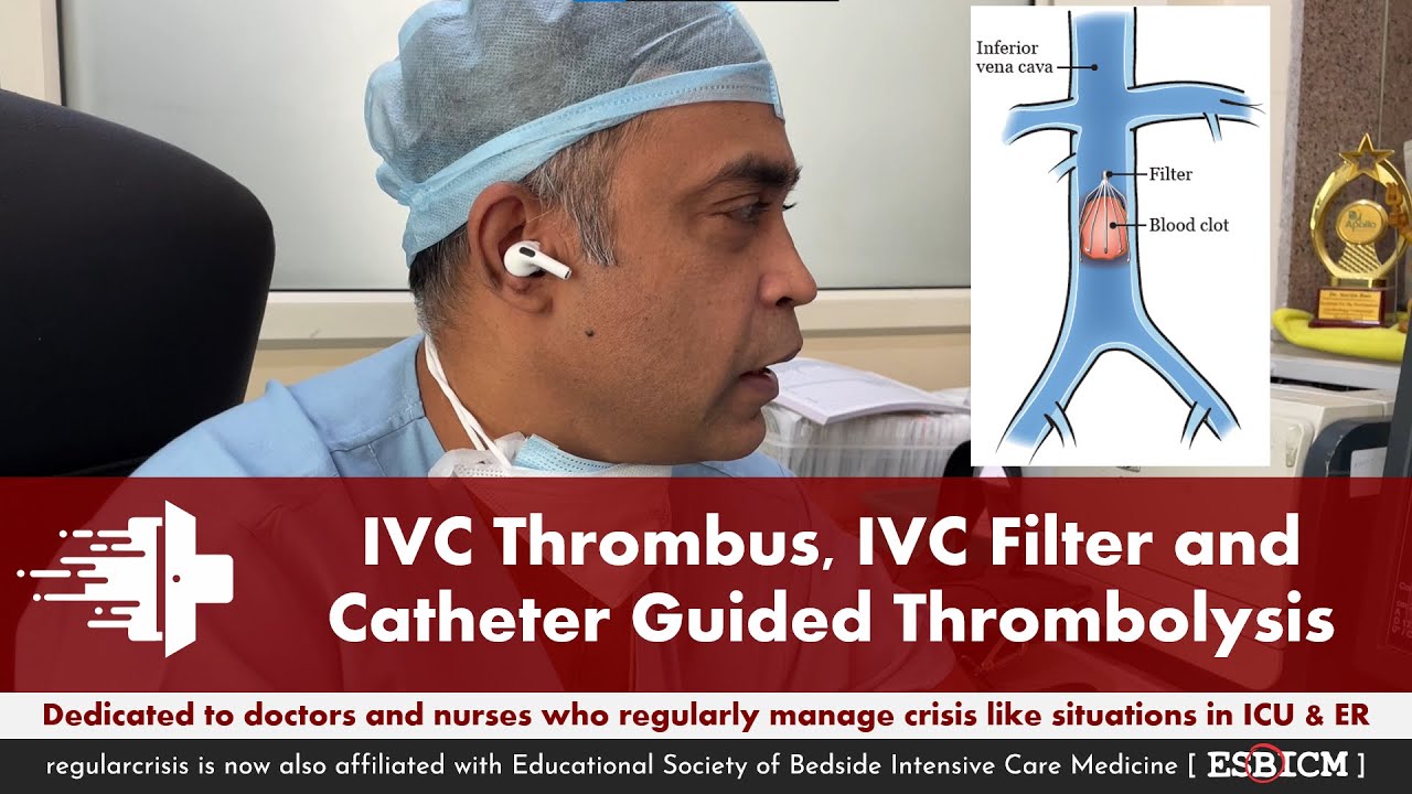 IVC Thrombus, IVC Filter and Catheter Guided Thrombolysis | ESBICM