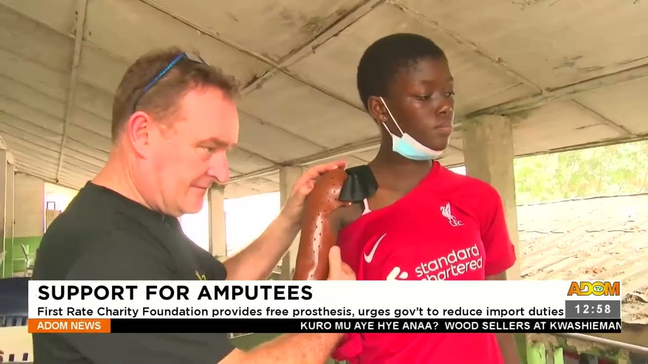 Support For Amputees: First Rate Charity Foundation provides free prosthetics (23-02-23)