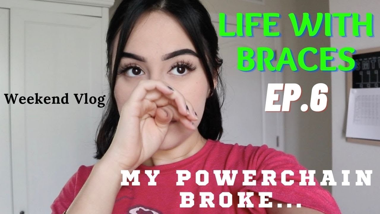 Life with braces Ep.6 My power chain broke // weekend vlog